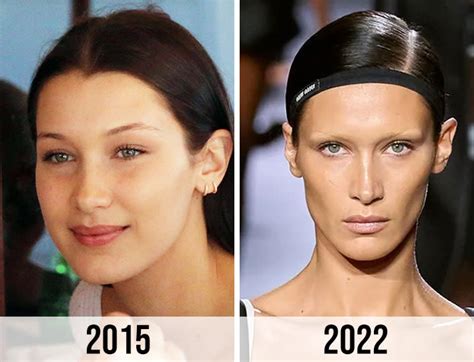 How to Get Bella Hadid’s Face: Fillers & Buccal Fat。